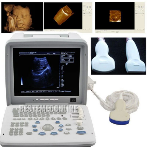 Portable Ultrasound Scanner (Mindry DP 10) - Image 2