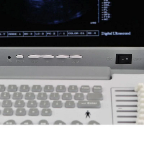 Portable Ultrasound Scanner (Mindry DP 10) - Image 4